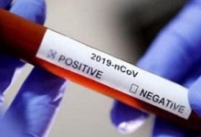 В Україні швидкі тести на коронавірус продаватимуть у аптеках