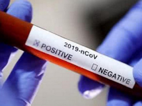 В Україні швидкі тести на коронавірус продаватимуть у аптеках