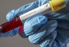 Експрес-тести на коронавірус будуть на Волині у середу-четвер, але вони оманливі