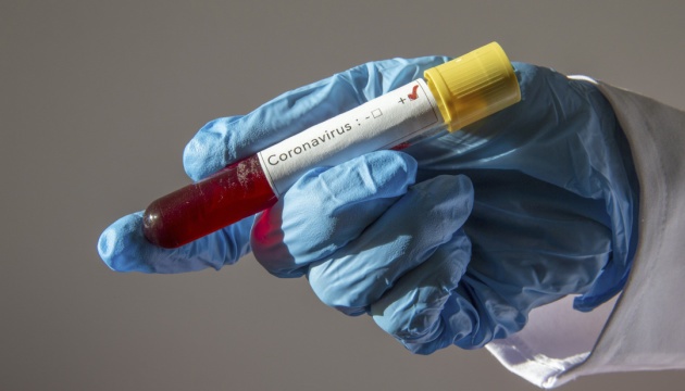 Експрес-тести на коронавірус будуть на Волині у середу-четвер, але вони оманливі