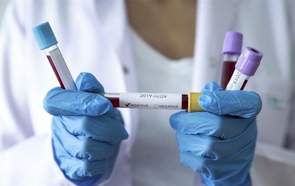В Україні 26 лабораторно підтверджених випадків інфікування коронавірусом