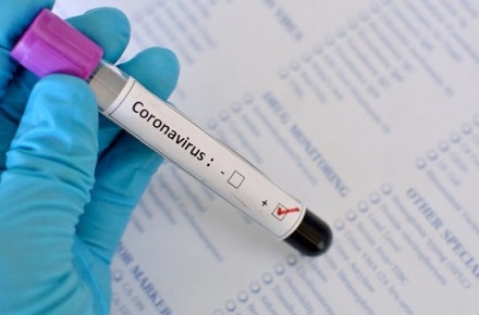 В Україні уже 73 підтверджені випадки коронавірусу