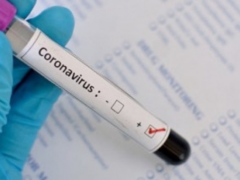 В Україні уже 73 підтверджені випадки коронавірусу