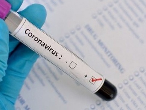 У Чернівецькій області зафіксували ще 4 хворих на коронавірус