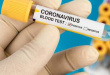 В Україну доставили 100 тисяч тестів на коронавірус