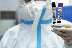 Україна вироблятиме тести на коронавірус