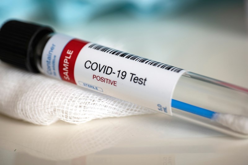 У 42-річної волинянки діагностували коронавірус