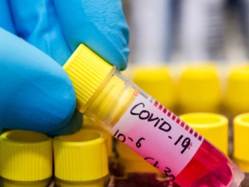 Україна отримає гуманітарну партію ліків для важко хворих на коронавірус