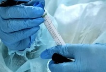 На Волині офіційно зареєстрованих 80 хворих на коронавірус