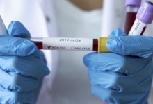Головна держінспекторка Поліської митниці підхопила коронавірус