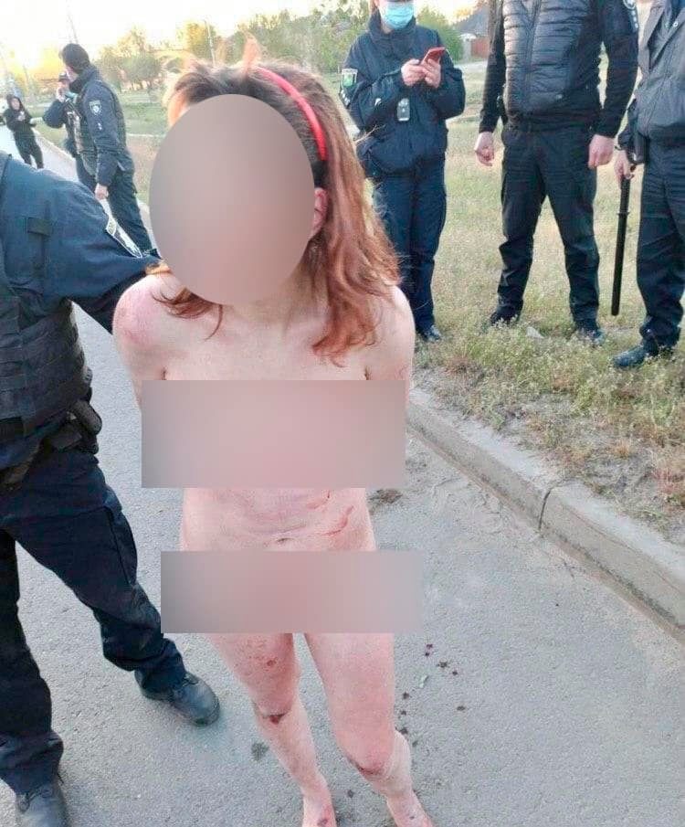 У Харкові гола жінка несла в пакеті голову 13-річної дитини. ФОТО 18+