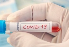 У МОЗ повідомили, коли українців почнуть масово тестувати на коронавірус