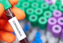 В яких районах Волині виявили нових хворих на коронавірус