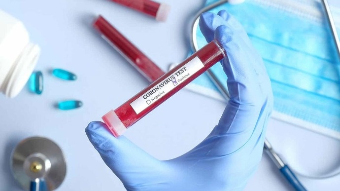 На Львівщині за добу у 200 людей виявили коронавірус