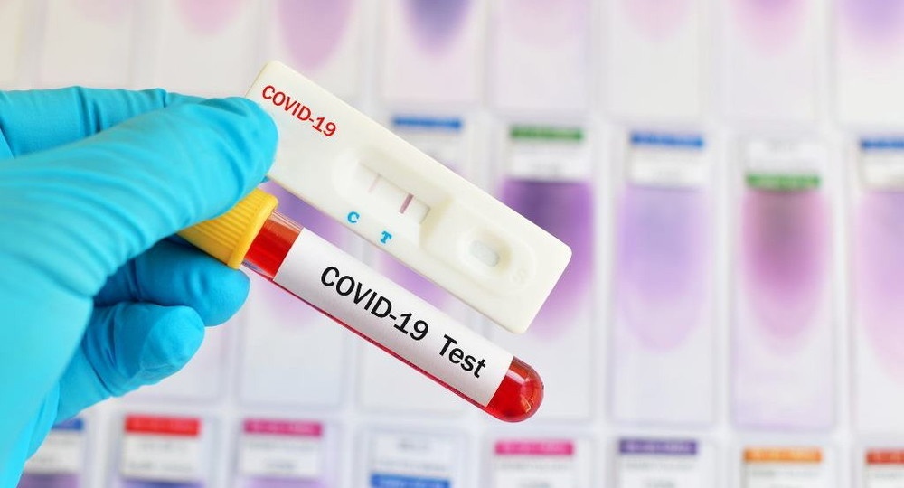 На Волині за добу в 70 осіб виявили коронавірус