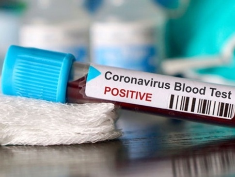 На Волині лікарні перезавантажені хворими на коронавірус: цифри