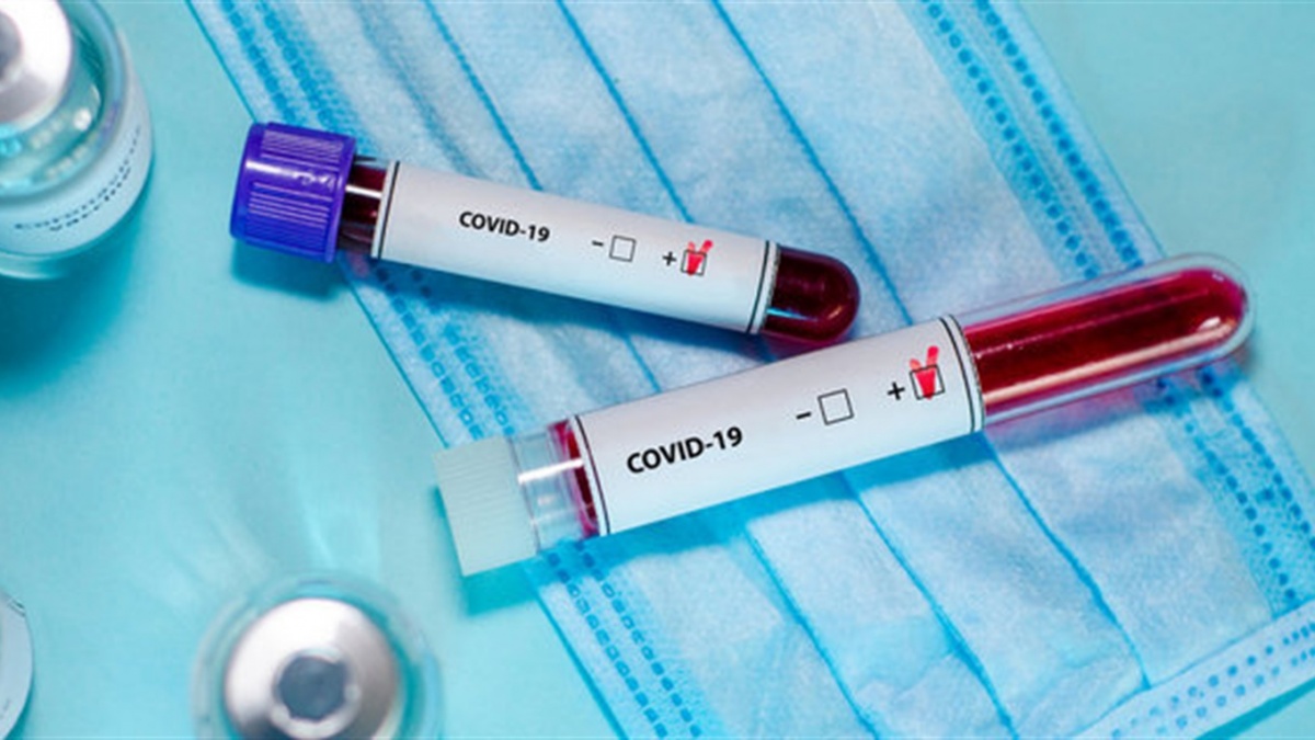 На Волині за добу – 45 нових хворих на коронавірус