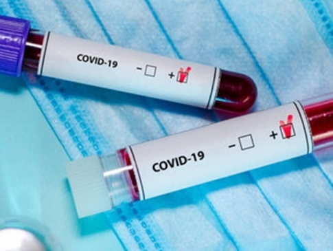 На Волині за добу – 45 нових хворих на коронавірус