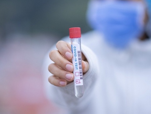 У МОЗ звітують про новий антирекорд з коронавірусу