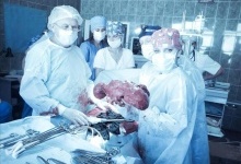 У Львові хірурги видалили жінці 10-ти кілограмову пухлину