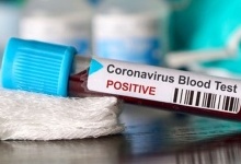 На Волині за добу померли двоє людей, у яких діагностували коронавірус