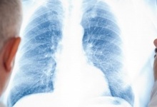 Лучани зможуть безкоштовно обстежити легені