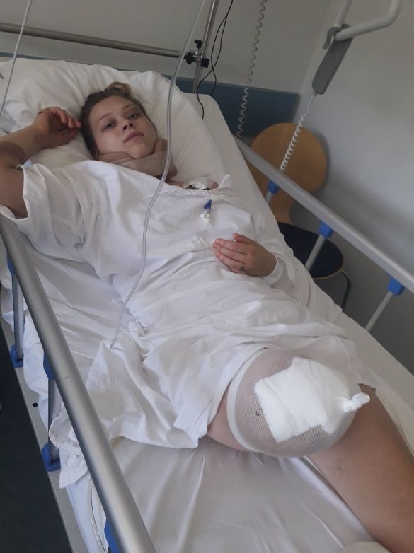19-річній українці відірвало ногу у ДТП в Польщі