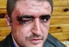 На Харківщині копи побили лікаря-анастезіолога