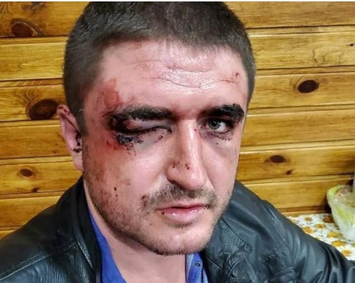 На Харківщині копи побили лікаря-анастезіолога