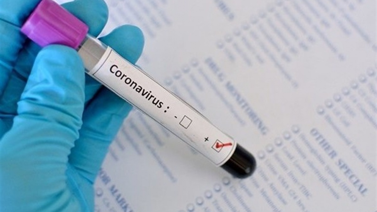 На Волині за добу – 5 смертей від коронавірусу