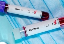 На Волині за добу – дві смерті від коронавірусу