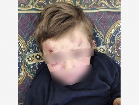 Струс мозку і перелом ноги: на Тернопільщині вітчим жорстоко побив 4-річну дитину