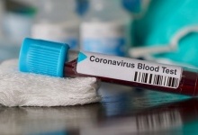 Коронавірус на Волині: за добу – сім смертей
