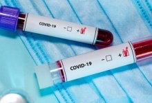 На Волині за добу померли 4 людини з діагностованим коронавірусом