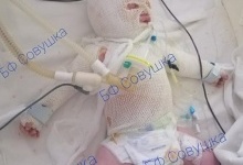 У Дніпрі рятують 2-місячного хлопчика, на якого сестра вилила окріп