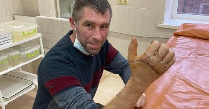 У Львові хірурги пришили чоловіку відрізану циркуляркою руку