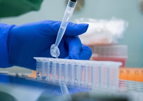 Українців безкоштовно перевірятимуть на антитіла до коронавірусу