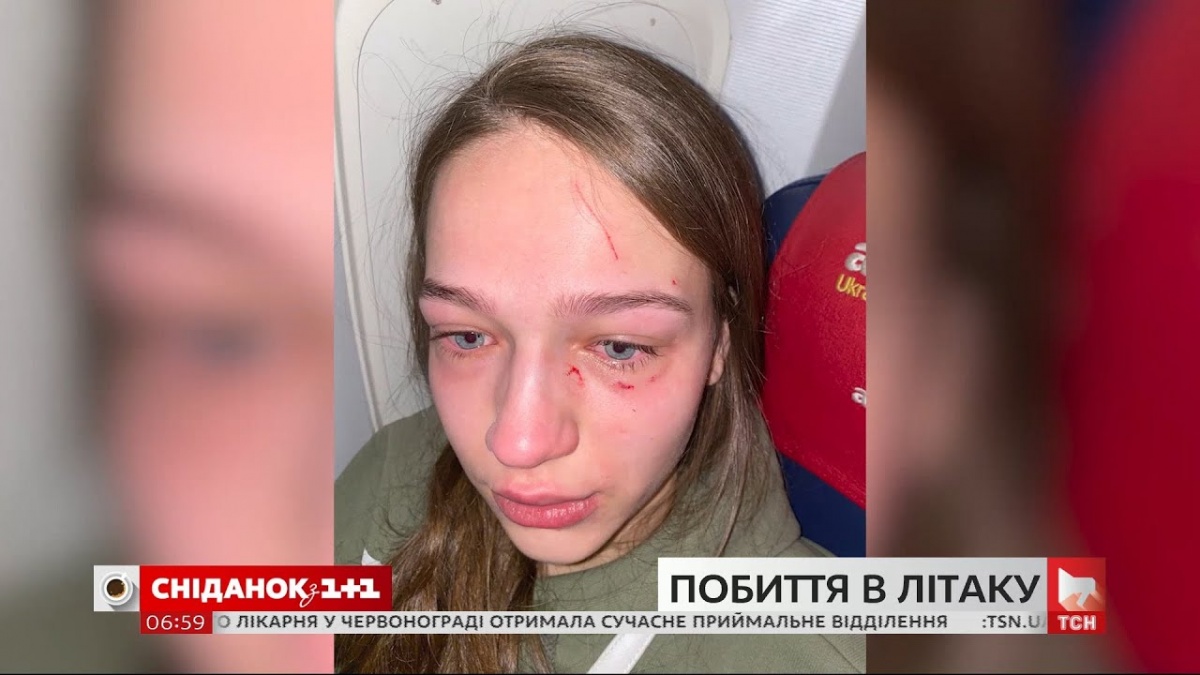 Бійка у літаку: українка з дитиною на руках розбила голову жінці