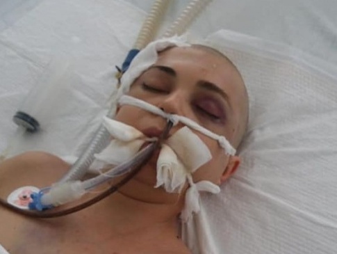 У Луцьку померла 32-річна багатодітна жінка, яку побив співмешканець