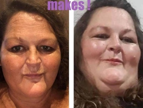 48-річна жінка схудла на 101 кілограм