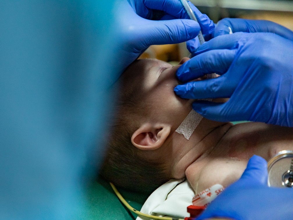 У Луцьку в дитячій лікарні відкрили 5 ліжок щелепно-лицевої хірургії