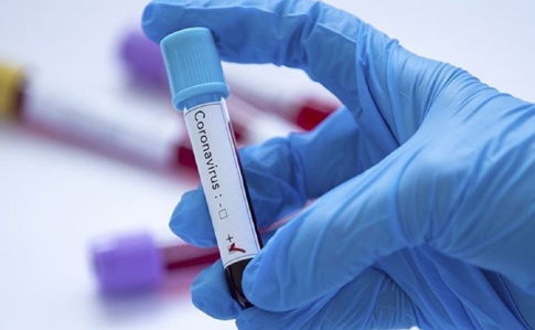 Лікарня в Луцьку отримала новий препарат від коронавірусу
