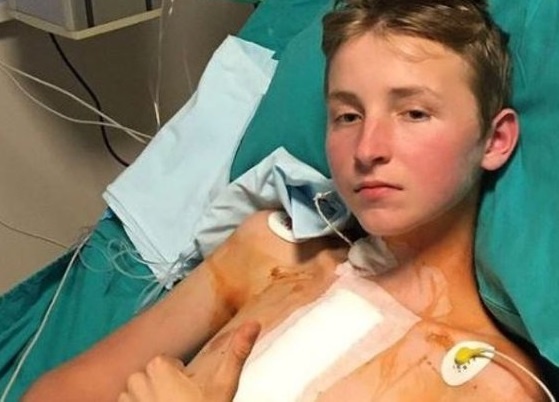 13-річний хлопчик з Волині з пересадженим серцем готується до виписки