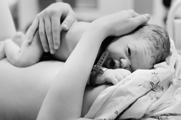 Волинські медики показали чуттєве відео народження малюка