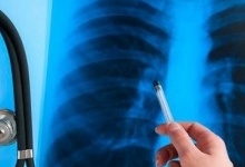 В Україні з'явився інноваційний препарат проти туберкульозу