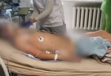 У Львові 17-річний хлопець впав у кому після безсимптомного ковіду