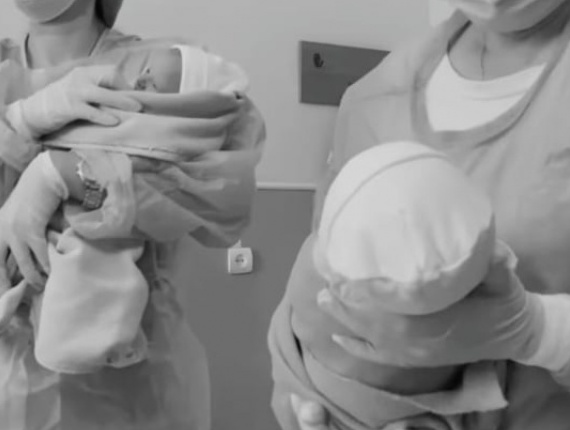 В лікарні на Волині показали народження двійні
