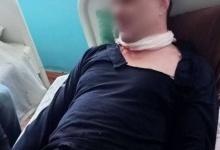 У Луцьку чоловік у лікарні порізав собі обличчя