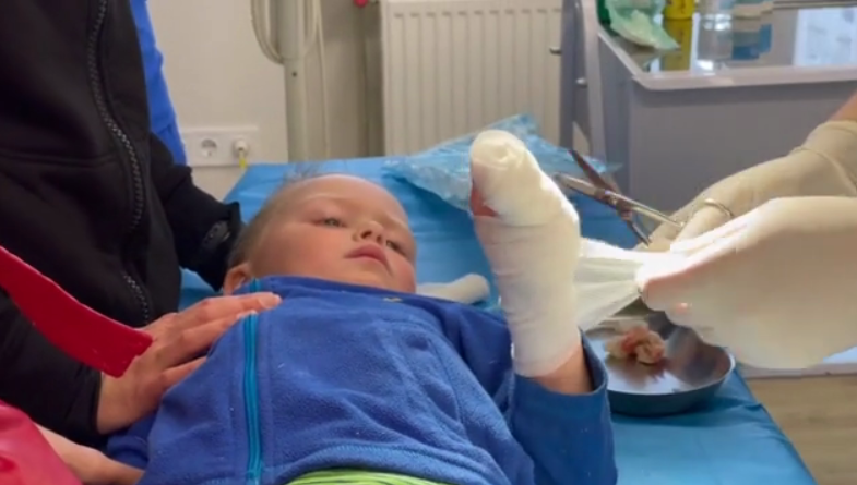 Прооперували 3-річну дитину, яка постраждала під час вибухів у Львові