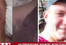 Жінка, побита сином директора Рівненської АЕС, померла (відео)